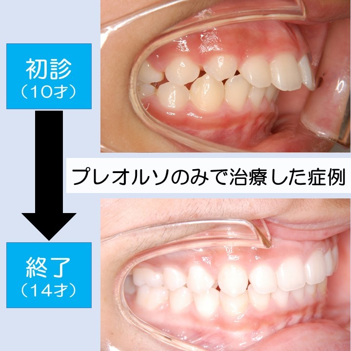 プレオルソ 今年最後のセミナーの締切りを 明日の朝10時に延長しました