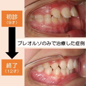 2022年１月のセミナー案内｜公式・岡山市の矯正歯科「大塚矯正歯科クリニック」